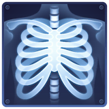 x-ray Emoji facebook